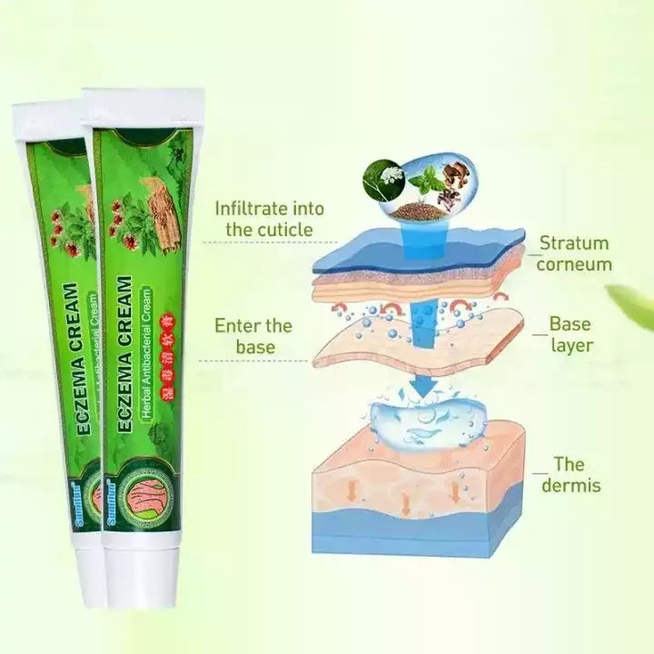 DermaCalm™ Crema Reparadora para Eczema y Piel Seca 🌿✨